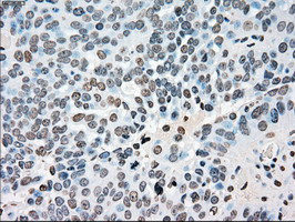 PLK1 Antibody in Immunohistochemistry (Paraffin) (IHC (P))