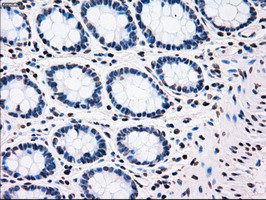 PLK1 Antibody in Immunohistochemistry (Paraffin) (IHC (P))