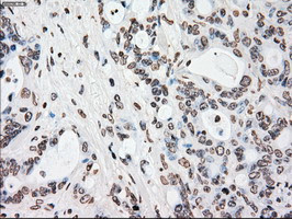 PLK1 Antibody in Immunohistochemistry (Paraffin) (IHC (P))