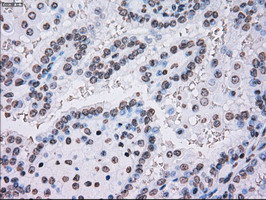 PLK1 Antibody in Immunohistochemistry (Paraffin) (IHC (P))