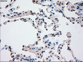 PLK1 Antibody in Immunohistochemistry (Paraffin) (IHC (P))