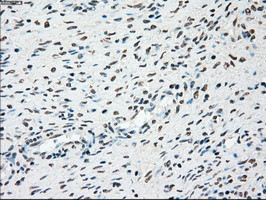 PLK1 Antibody in Immunohistochemistry (Paraffin) (IHC (P))