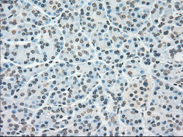 PLK1 Antibody in Immunohistochemistry (Paraffin) (IHC (P))