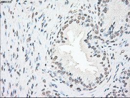 PLK1 Antibody in Immunohistochemistry (Paraffin) (IHC (P))