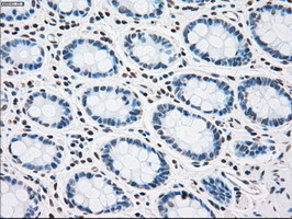 PLK1 Antibody in Immunohistochemistry (Paraffin) (IHC (P))