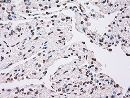 PLK1 Antibody in Immunohistochemistry (Paraffin) (IHC (P))