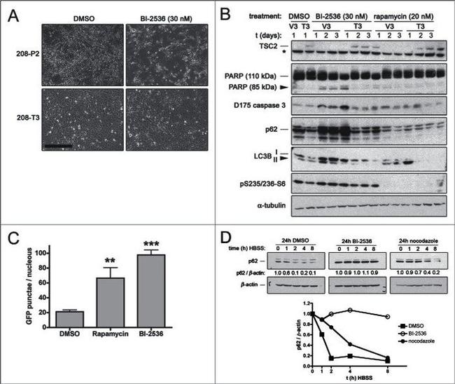 TSC1 Antibody in Western Blot (WB)