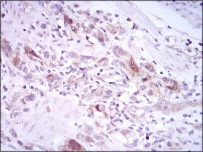 PLK1 Antibody in Immunohistochemistry (Paraffin) (IHC (P))