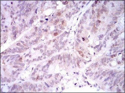 PLK1 Antibody in Immunohistochemistry (Paraffin) (IHC (P))