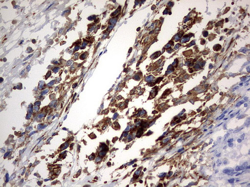 PLOD2 Antibody in Immunohistochemistry (Paraffin) (IHC (P))