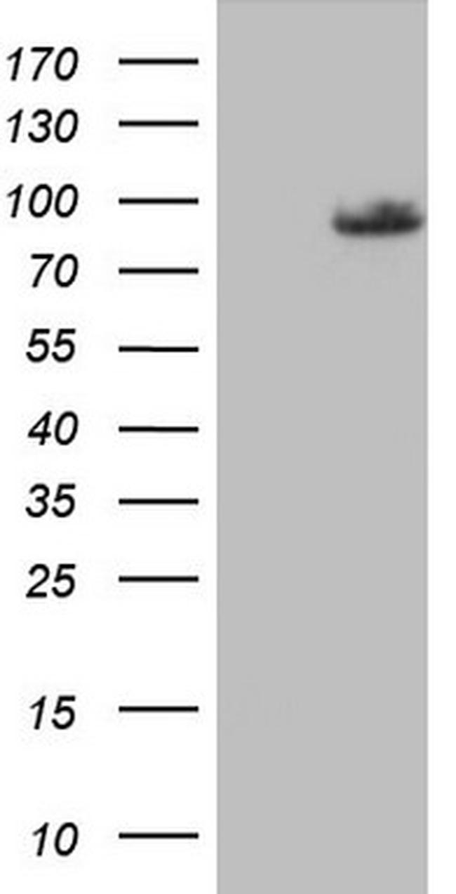 PLOD2 Antibody in Western Blot (WB)