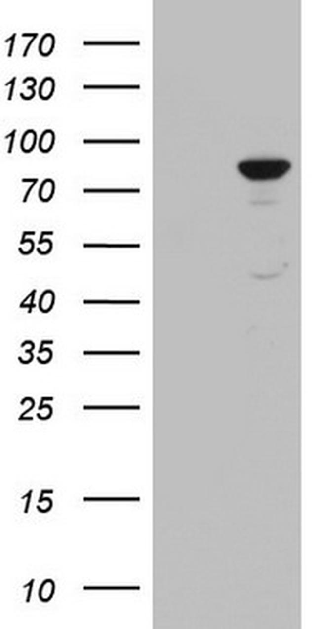 PLOD2 Antibody in Western Blot (WB)