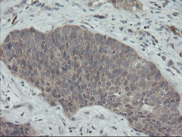 PMEL Antibody in Immunohistochemistry (Paraffin) (IHC (P))