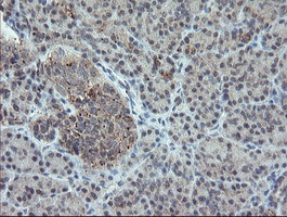 PMEL Antibody in Immunohistochemistry (Paraffin) (IHC (P))