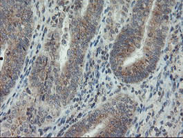 PMEL Antibody in Immunohistochemistry (Paraffin) (IHC (P))