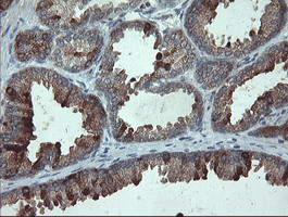 PMEL Antibody in Immunohistochemistry (Paraffin) (IHC (P))