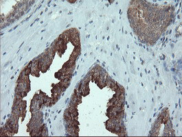 PMEL Antibody in Immunohistochemistry (Paraffin) (IHC (P))