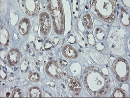 PMEL Antibody in Immunohistochemistry (Paraffin) (IHC (P))