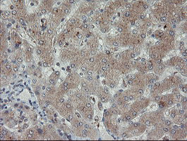 PMEL Antibody in Immunohistochemistry (Paraffin) (IHC (P))