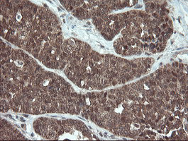 PMEL Antibody in Immunohistochemistry (Paraffin) (IHC (P))