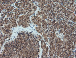 PMEL Antibody in Immunohistochemistry (Paraffin) (IHC (P))