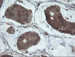 PMEL Antibody in Immunohistochemistry (Paraffin) (IHC (P))