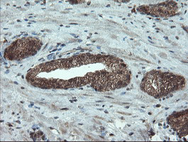 PMEL Antibody in Immunohistochemistry (Paraffin) (IHC (P))