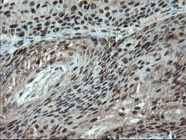 PMEL Antibody in Immunohistochemistry (Paraffin) (IHC (P))