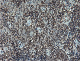 PMEL Antibody in Immunohistochemistry (Paraffin) (IHC (P))