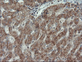 PMEL Antibody in Immunohistochemistry (Paraffin) (IHC (P))