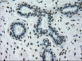 PMEL Antibody in Immunohistochemistry (Paraffin) (IHC (P))