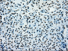 PMEL Antibody in Immunohistochemistry (Paraffin) (IHC (P))