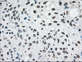 PMEL Antibody in Immunohistochemistry (Paraffin) (IHC (P))