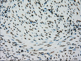 PMEL Antibody in Immunohistochemistry (Paraffin) (IHC (P))