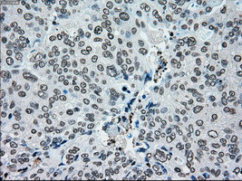 PMEL Antibody in Immunohistochemistry (Paraffin) (IHC (P))