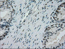 PMEL Antibody in Immunohistochemistry (Paraffin) (IHC (P))