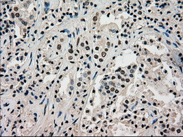 PMEL Antibody in Immunohistochemistry (Paraffin) (IHC (P))