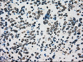 PMEL Antibody in Immunohistochemistry (Paraffin) (IHC (P))