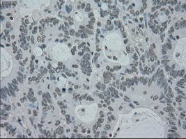 PMEL Antibody in Immunohistochemistry (Paraffin) (IHC (P))