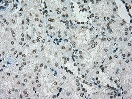 PMEL Antibody in Immunohistochemistry (Paraffin) (IHC (P))