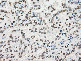 PMEL Antibody in Immunohistochemistry (Paraffin) (IHC (P))