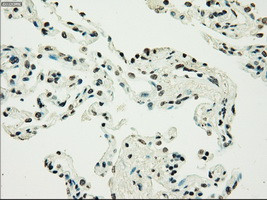 PMEL Antibody in Immunohistochemistry (Paraffin) (IHC (P))