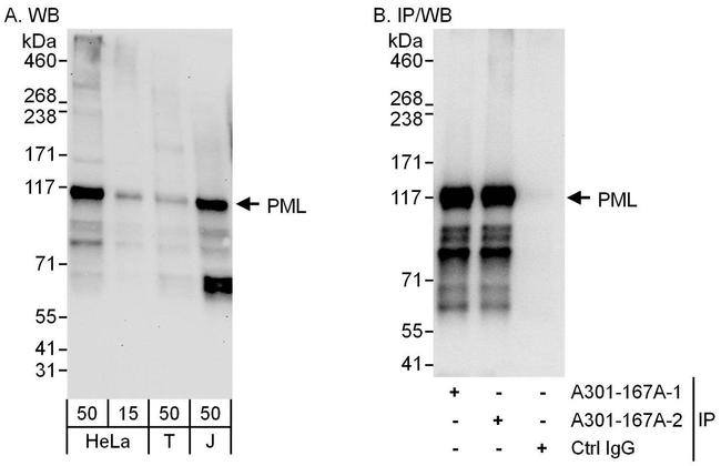 PML Antibody in Western Blot (WB)