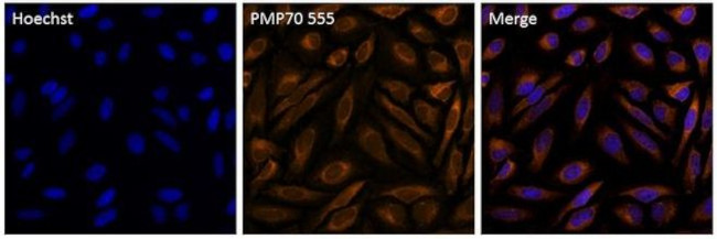 PMP70 Antibody in Immunocytochemistry (ICC/IF)