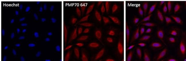 PMP70 Antibody in Immunocytochemistry (ICC/IF)