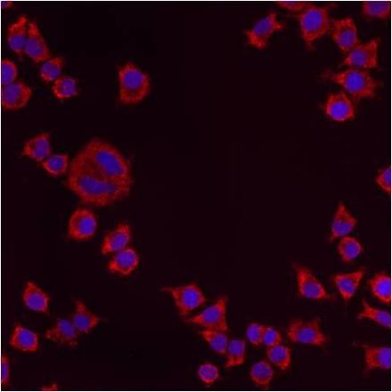 PMP70 Antibody in Immunocytochemistry (ICC/IF)