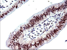 PMS2 Antibody in Immunohistochemistry (Paraffin) (IHC (P))