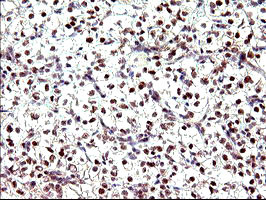 PMS2 Antibody in Immunohistochemistry (Paraffin) (IHC (P))