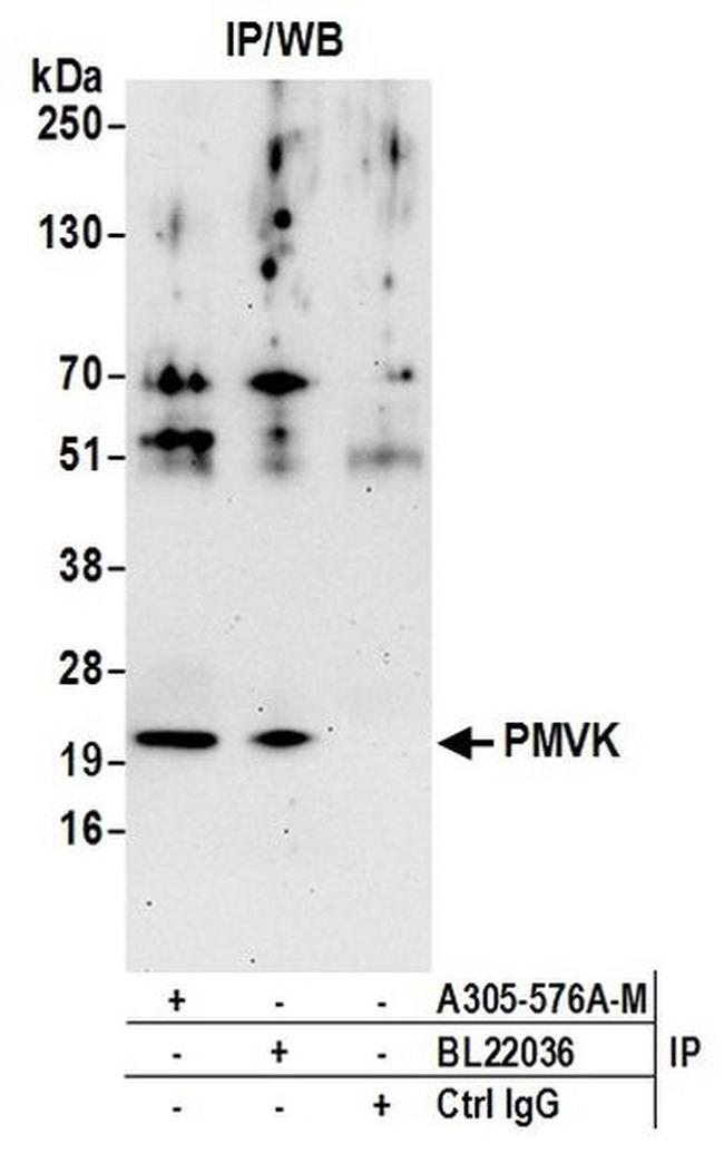 PMVK Antibody in Western Blot (WB)