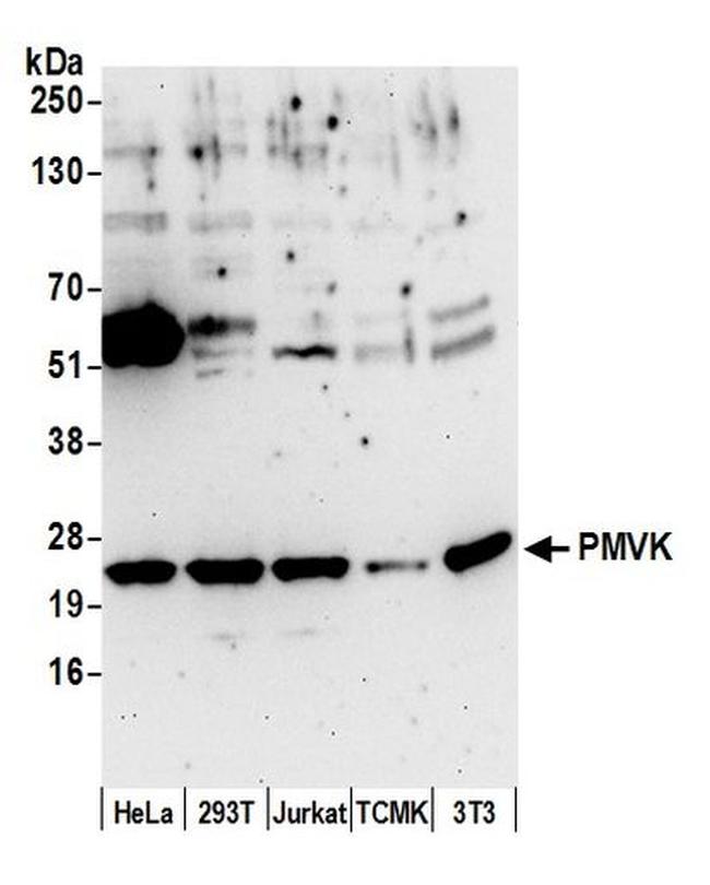 PMVK Antibody in Western Blot (WB)